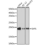 Western Blot - Anti-Skp1 Antibody [ARC1384] (A306186) - Antibodies.com