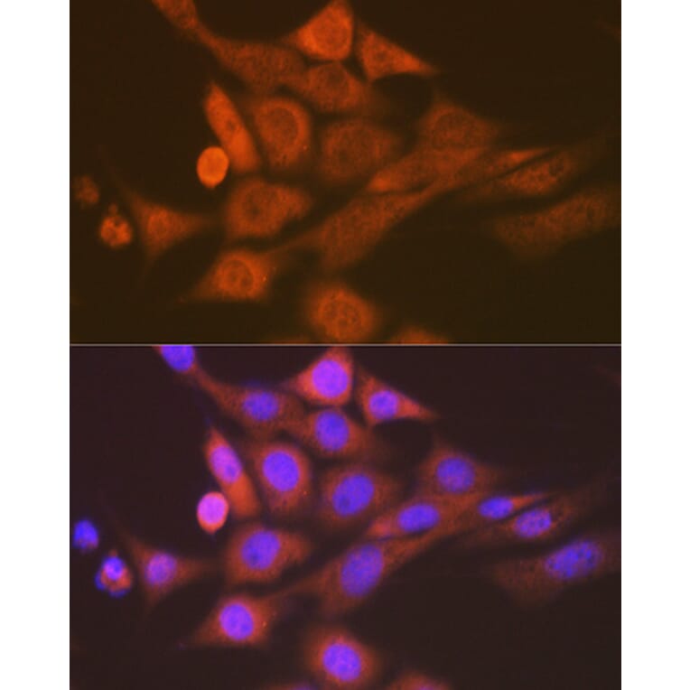Immunofluorescence - Anti-Skp1 Antibody [ARC1384] (A306186) - Antibodies.com
