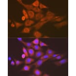 Immunofluorescence - Anti-Skp1 Antibody [ARC1384] (A306186) - Antibodies.com