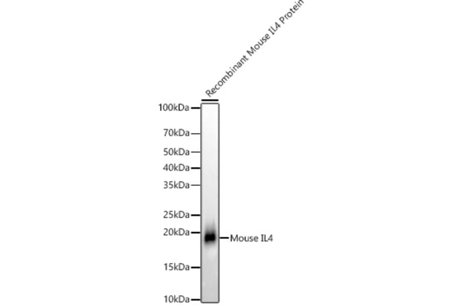Western Blot - Anti-IL-4 Antibody [ARC56660] (A306189) - Antibodies.com