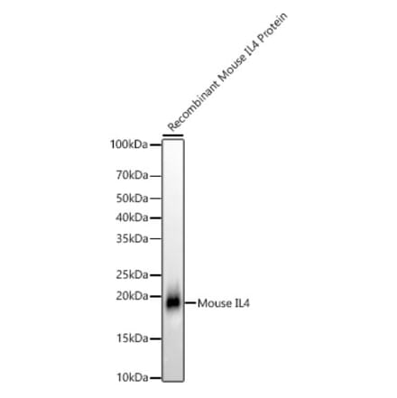Western Blot - Anti-IL-4 Antibody [ARC56660] (A306189) - Antibodies.com
