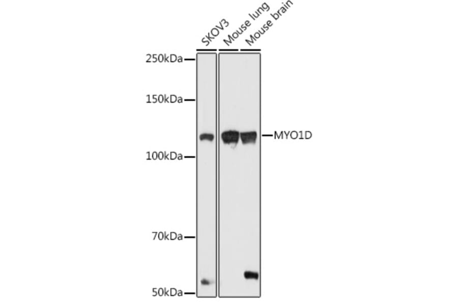 Western Blot - Anti-MYO1D Antibody (A306190) - Antibodies.com