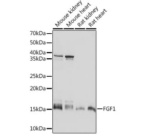 Western Blot - Anti-FGF1 Antibody [ARC1414] (A306191) - Antibodies.com