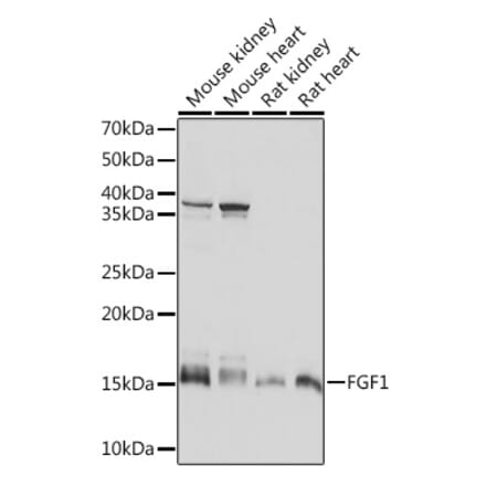 Western Blot - Anti-FGF1 Antibody [ARC1414] (A306191) - Antibodies.com