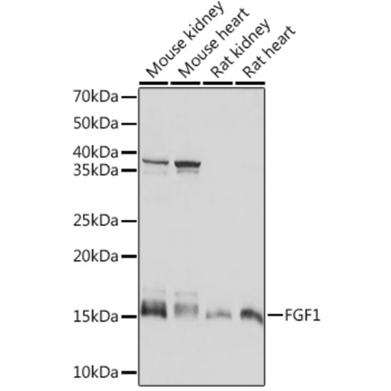 Western Blot - Anti-FGF1 Antibody [ARC1414] (A306191) - Antibodies.com