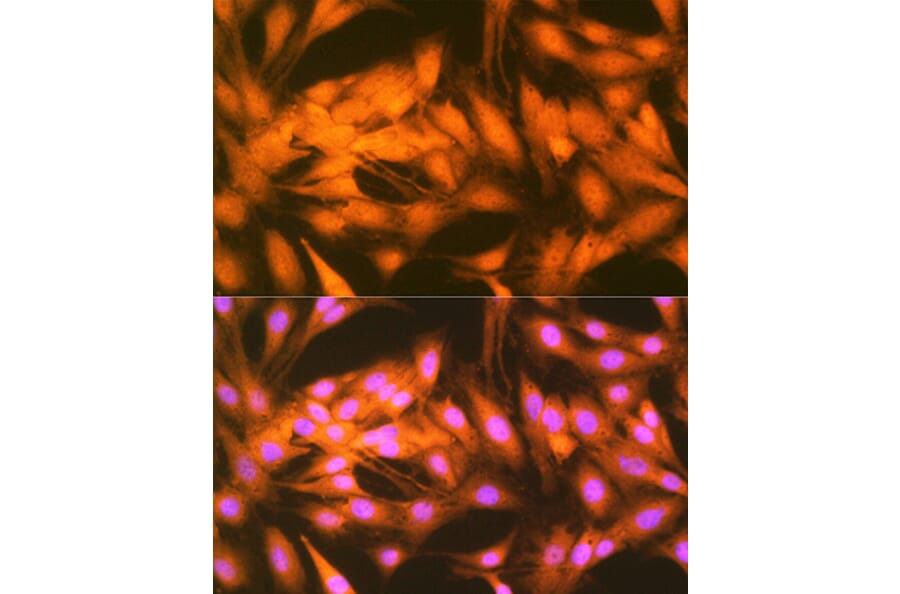 Immunofluorescence - Anti-FGF1 Antibody [ARC1414] (A306191) - Antibodies.com
