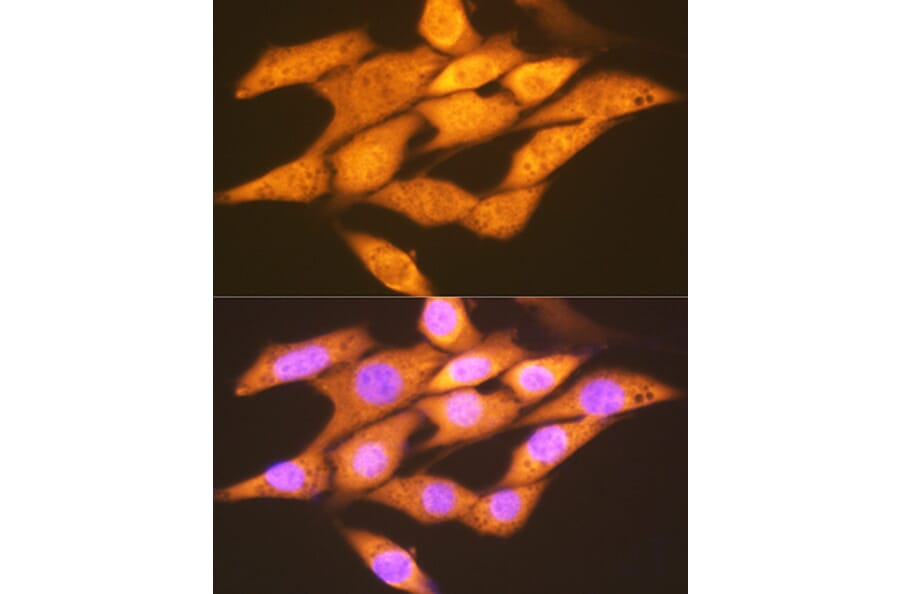 Immunofluorescence - Anti-FGF1 Antibody [ARC1414] (A306191) - Antibodies.com
