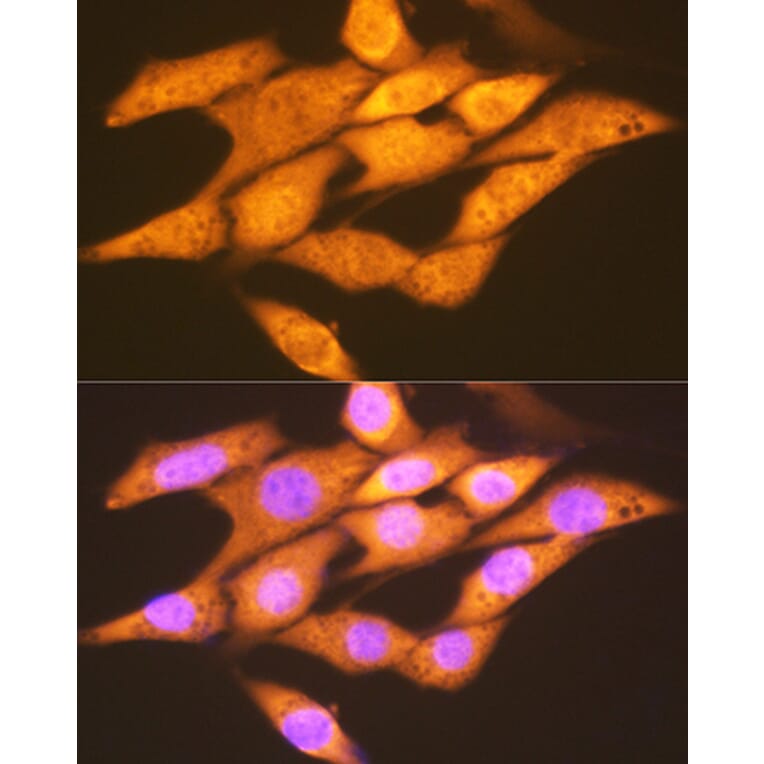 Immunofluorescence - Anti-FGF1 Antibody [ARC1414] (A306191) - Antibodies.com