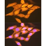 Immunofluorescence - Anti-FGF1 Antibody [ARC1414] (A306191) - Antibodies.com