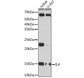 Western Blot - Anti-IL-4 Antibody [ARC1266] (A306194) - Antibodies.com