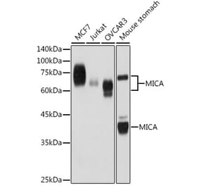 Western Blot - Anti-MICA Antibody [ARC2422] (A306195) - Antibodies.com