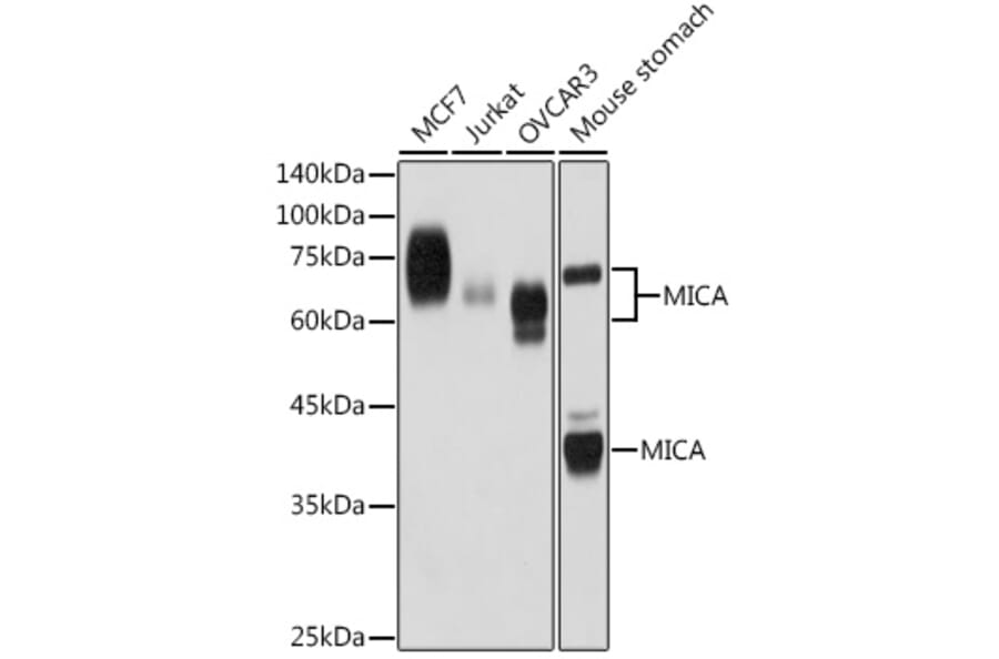 Western Blot - Anti-MICA Antibody [ARC2422] (A306195) - Antibodies.com