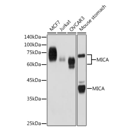 Western Blot - Anti-MICA Antibody [ARC2422] (A306195) - Antibodies.com