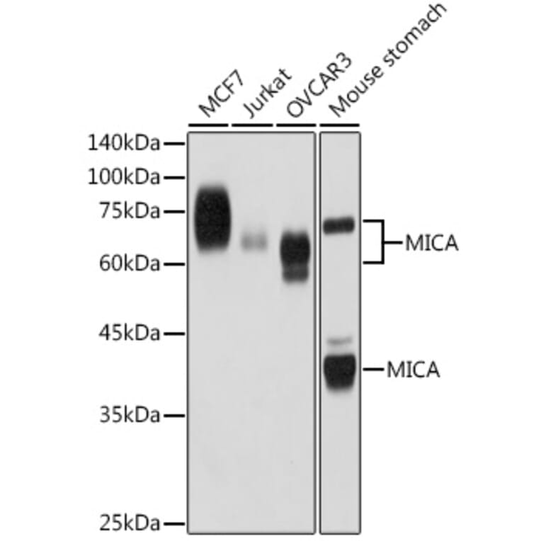 Western Blot - Anti-MICA Antibody [ARC2422] (A306195) - Antibodies.com