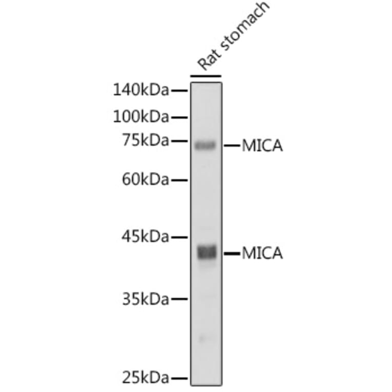 Western Blot - Anti-MICA Antibody [ARC2422] (A306195) - Antibodies.com