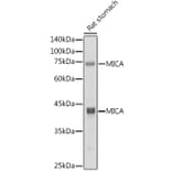 Western Blot - Anti-MICA Antibody [ARC2422] (A306195) - Antibodies.com