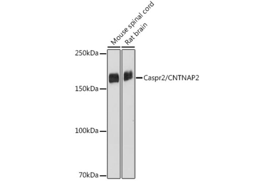 Western Blot - Anti-Caspr2/CNTNAP2 Antibody [ARC2430] (A306196) - Antibodies.com