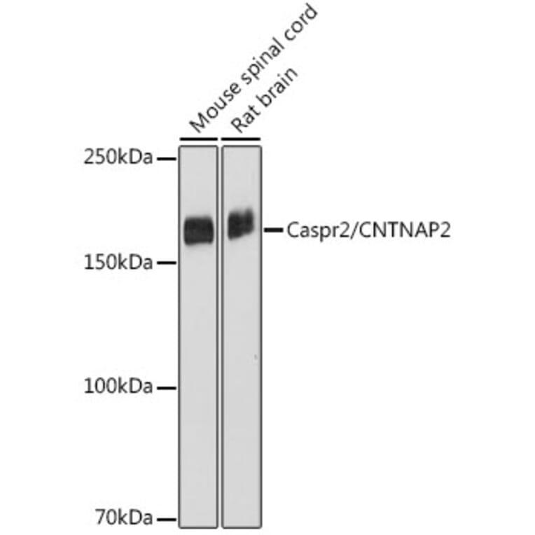 Western Blot - Anti-Caspr2/CNTNAP2 Antibody [ARC2430] (A306196) - Antibodies.com