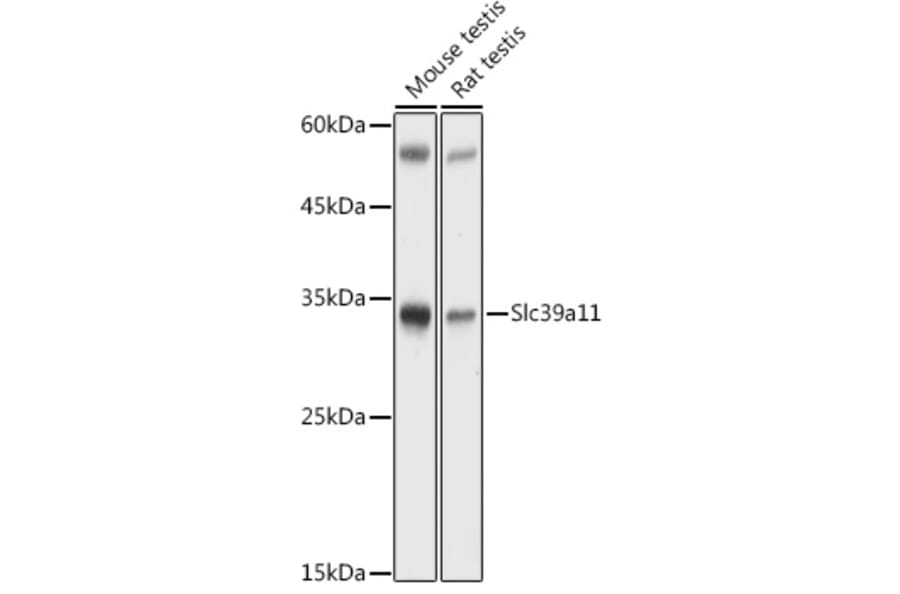 Western Blot - Anti-Slc39a11 Antibody (A306197) - Antibodies.com
