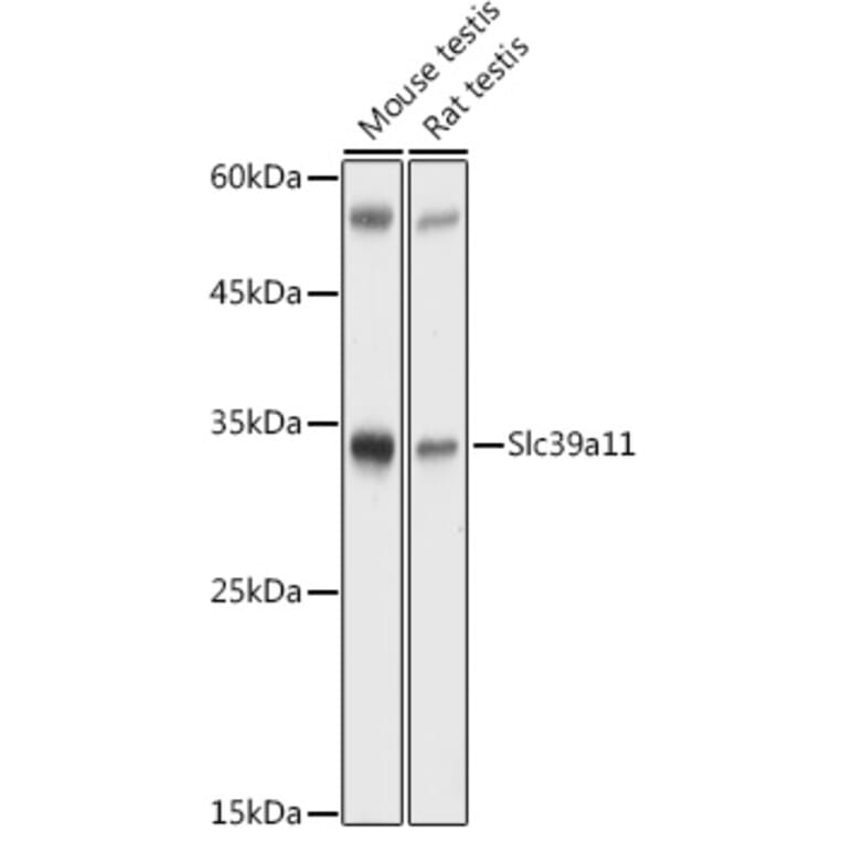 Western Blot - Anti-Slc39a11 Antibody (A306197) - Antibodies.com