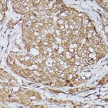 Immunohistochemistry - Anti-Slc39a11 Antibody (A306197) - Antibodies.com