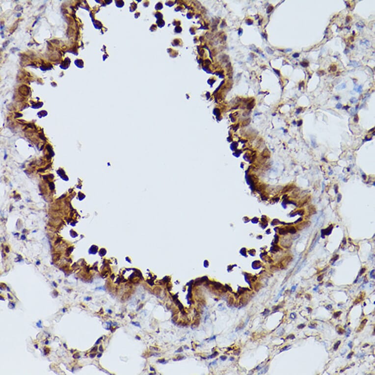 Immunohistochemistry - Anti-Slc39a11 Antibody (A306197) - Antibodies.com
