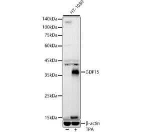 Western Blot - Anti-GDF15 Antibody [ARC55565] (A306198) - Antibodies.com