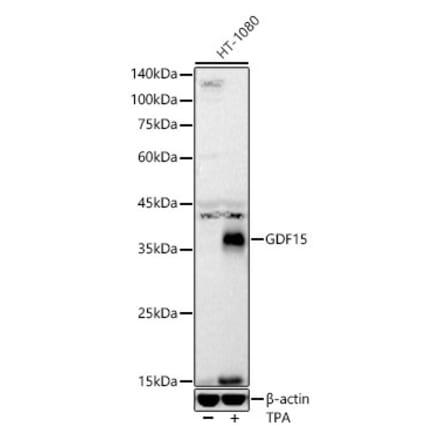 Western Blot - Anti-GDF15 Antibody [ARC55565] (A306198) - Antibodies.com