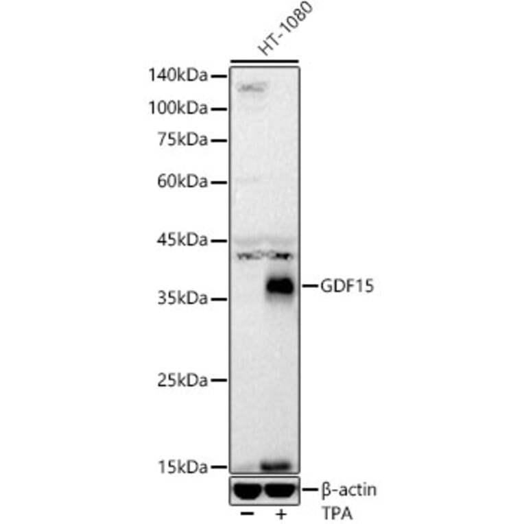 Western Blot - Anti-GDF15 Antibody [ARC55565] (A306198) - Antibodies.com
