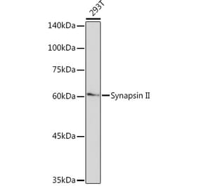 Western Blot - Anti-SYN2 Antibody [ARC2166] (A306199) - Antibodies.com