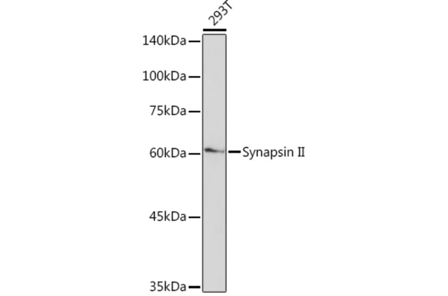 Western Blot - Anti-SYN2 Antibody [ARC2166] (A306199) - Antibodies.com