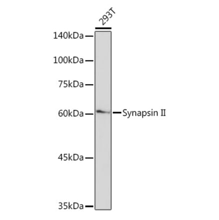 Western Blot - Anti-SYN2 Antibody [ARC2166] (A306199) - Antibodies.com