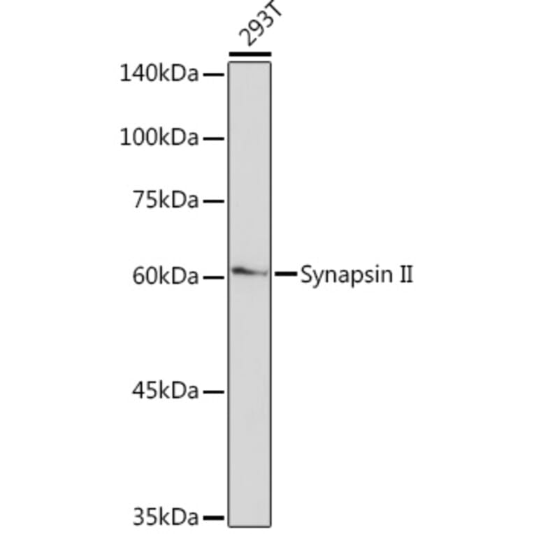 Western Blot - Anti-SYN2 Antibody [ARC2166] (A306199) - Antibodies.com