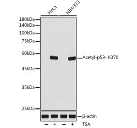 Western Blot - Anti-p53 (acetyl Lys370) Antibody (A306200) - Antibodies.com