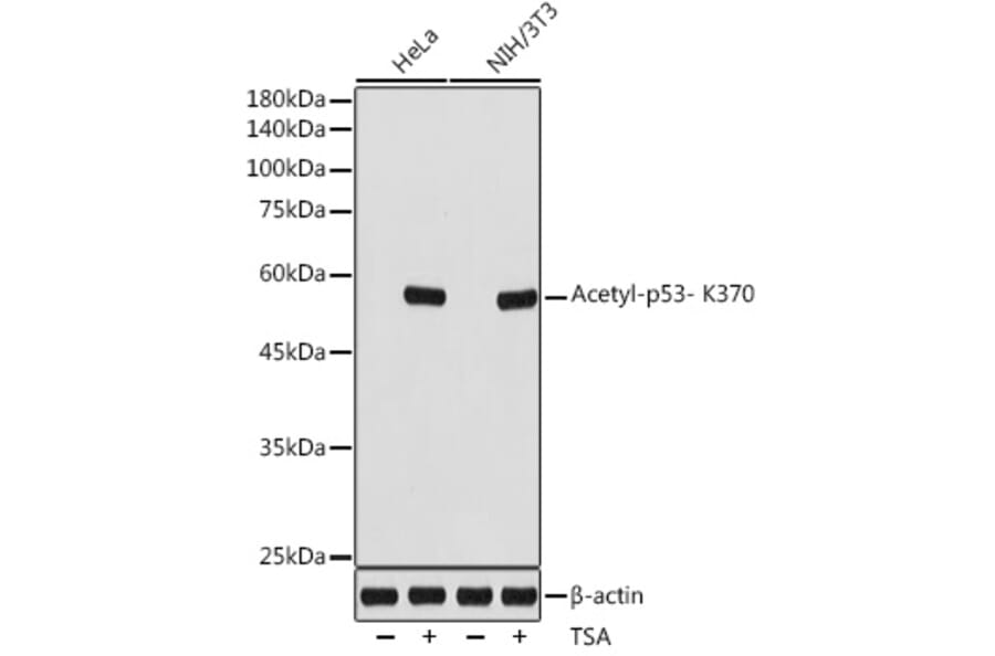 Western Blot - Anti-p53 (acetyl Lys370) Antibody [ARC2368] (A306200) - Antibodies.com