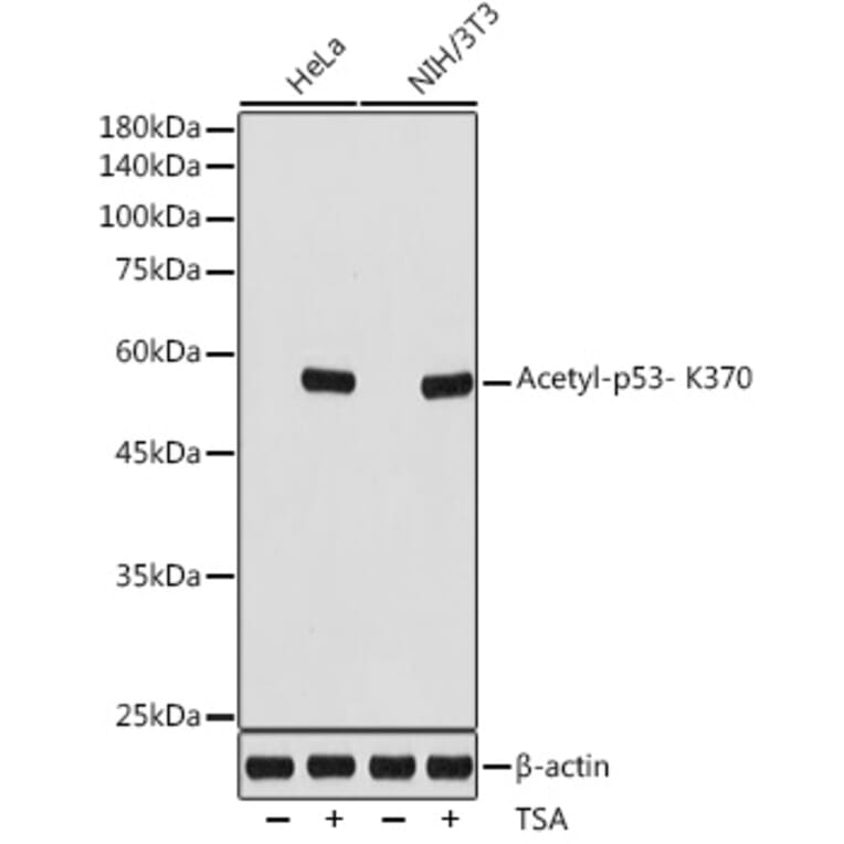 Western Blot - Anti-p53 (acetyl Lys370) Antibody [ARC2368] (A306200) - Antibodies.com