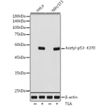 Western Blot - Anti-p53 (acetyl Lys370) Antibody [ARC2368] (A306200) - Antibodies.com