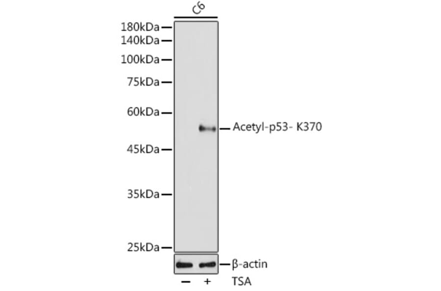 Western Blot - Anti-p53 (acetyl Lys370) Antibody [ARC2368] (A306200) - Antibodies.com