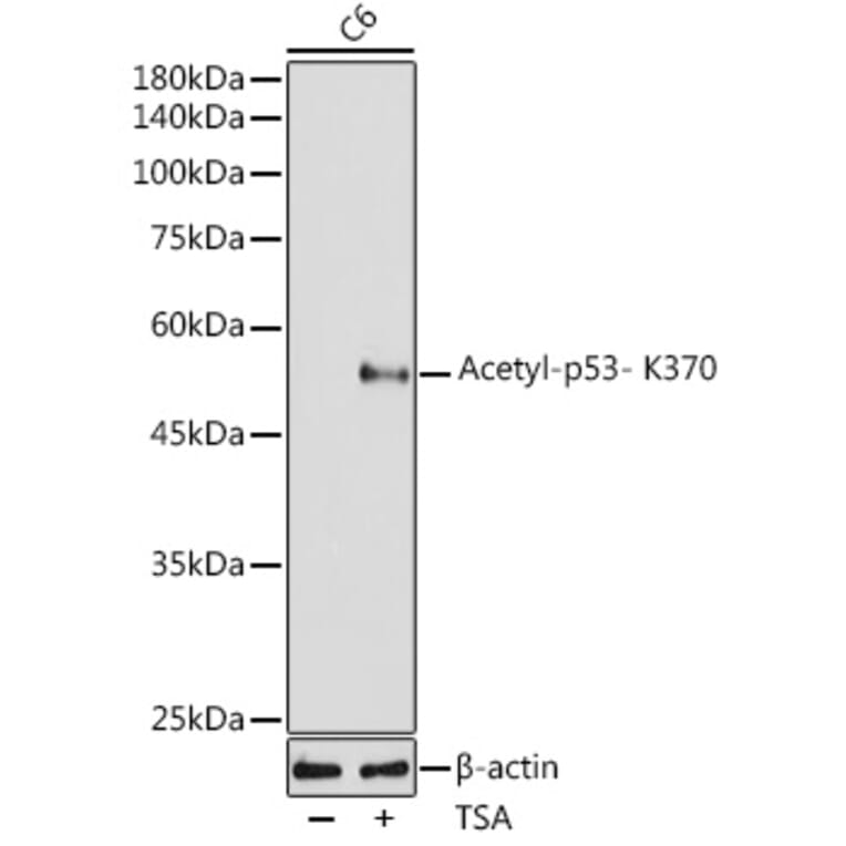 Western Blot - Anti-p53 (acetyl Lys370) Antibody [ARC2368] (A306200) - Antibodies.com