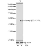 Western Blot - Anti-p53 (acetyl Lys370) Antibody [ARC2368] (A306200) - Antibodies.com