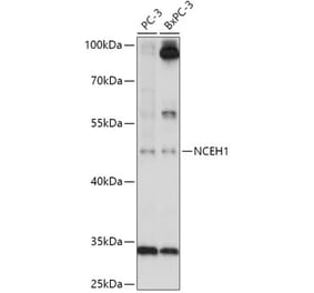 Western Blot - Anti-AADACL1 Antibody (A306201) - Antibodies.com