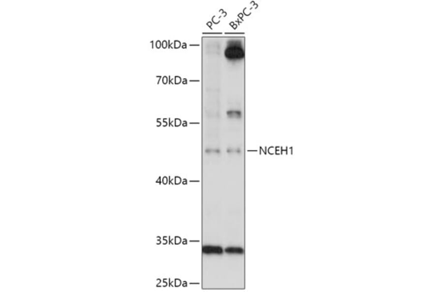 Western Blot - Anti-AADACL1 Antibody (A306201) - Antibodies.com