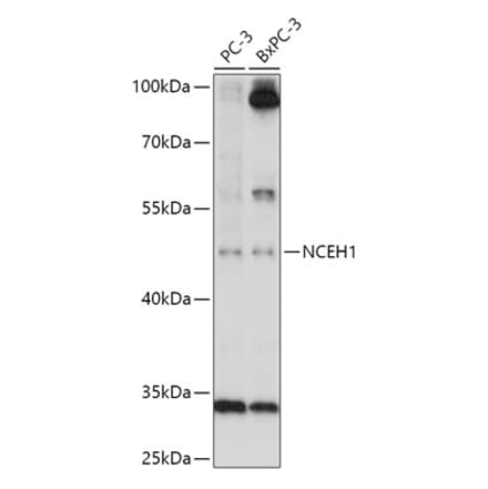 Western Blot - Anti-AADACL1 Antibody (A306201) - Antibodies.com