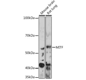 Western Blot - Anti-MiTF Antibody [ARC0660] (A306202) - Antibodies.com