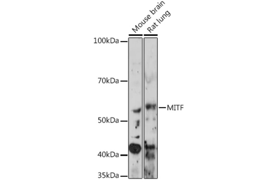 Western Blot - Anti-MiTF Antibody [ARC0660] (A306202) - Antibodies.com
