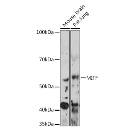 Western Blot - Anti-MiTF Antibody [ARC0660] (A306202) - Antibodies.com