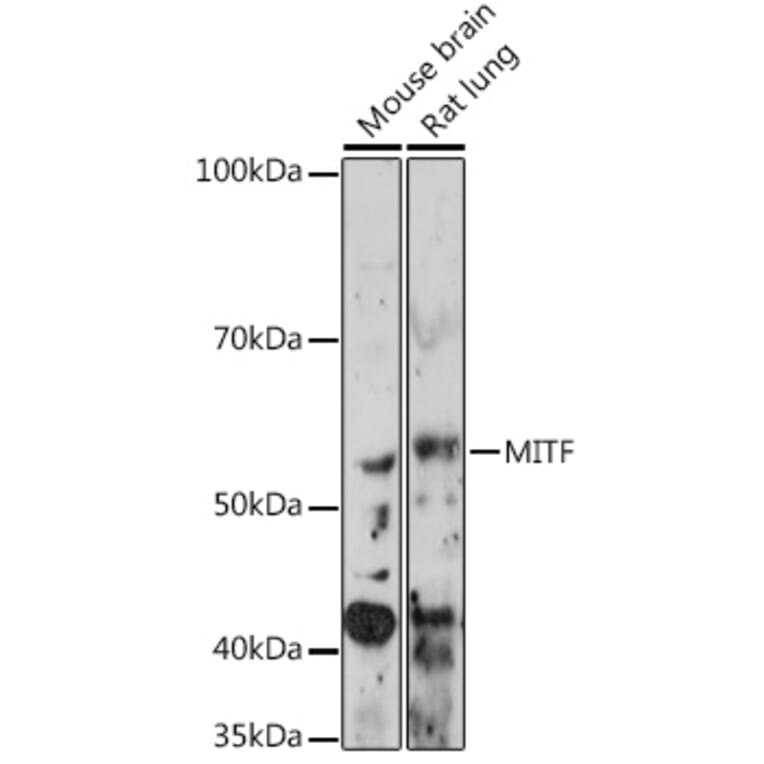 Western Blot - Anti-MiTF Antibody [ARC0660] (A306202) - Antibodies.com