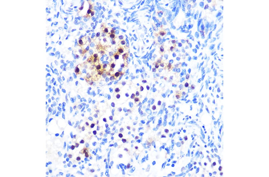 Immunohistochemistry - Anti-MiTF Antibody [ARC0660] (A306202) - Antibodies.com