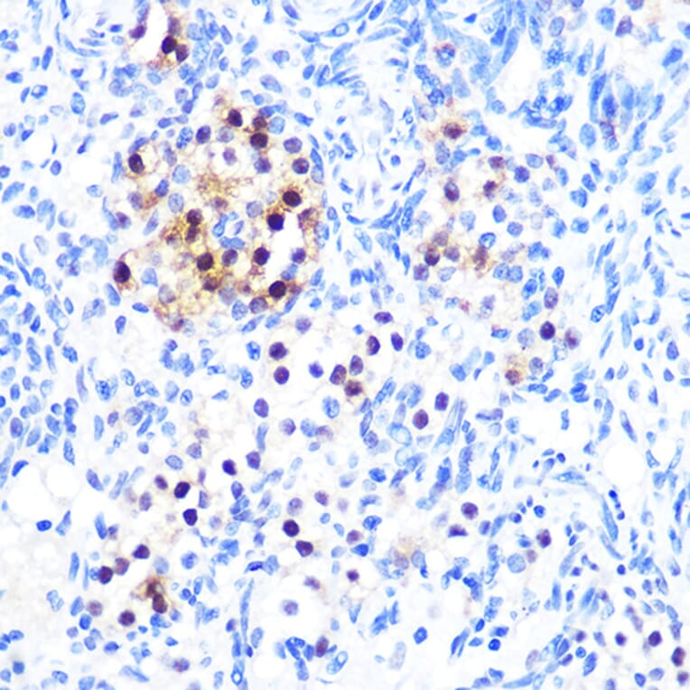 Immunohistochemistry - Anti-MiTF Antibody [ARC0660] (A306202) - Antibodies.com