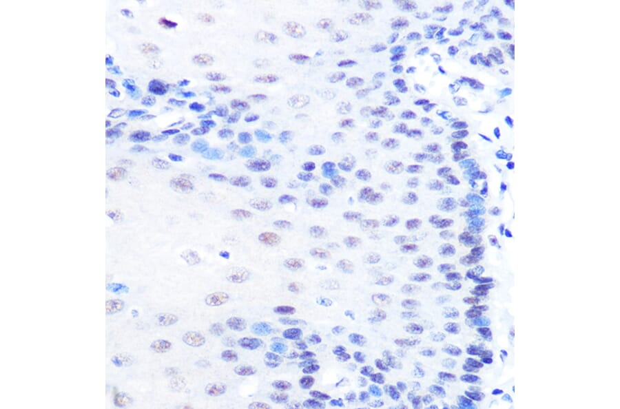 Immunohistochemistry - Anti-MiTF Antibody [ARC0660] (A306202) - Antibodies.com